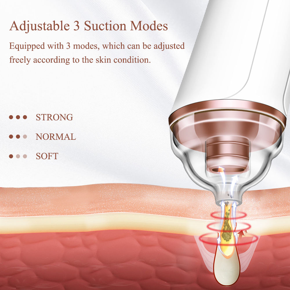 შავი წერტილების მოცილების ელექტრო ინსტრუმენტი