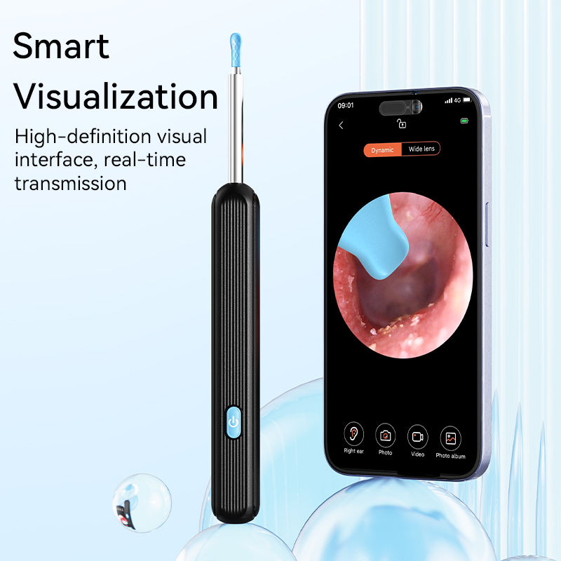 ელექტრო ყურის კოვზი კამერით